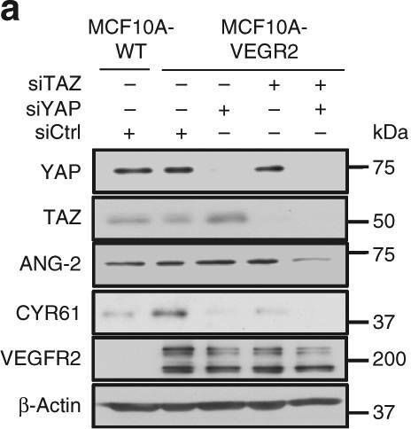 Fig.5.A showing Western Blotting from the publication: A LATS biosensor screen identifies VEGFR as a regulator of the Hippo pathway in angiogenesis.