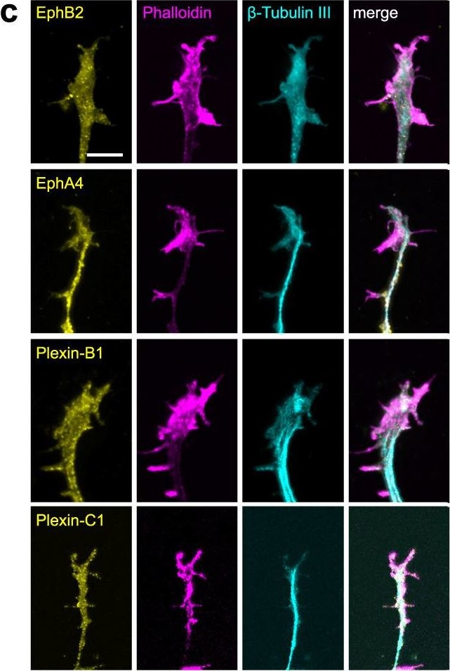 Fig.7.C showing Immunocytochemistry-immunofluorescence from the publication: Guidance landscapes unveiled by quantitative proteomics to control reinnervation in adult visual system.