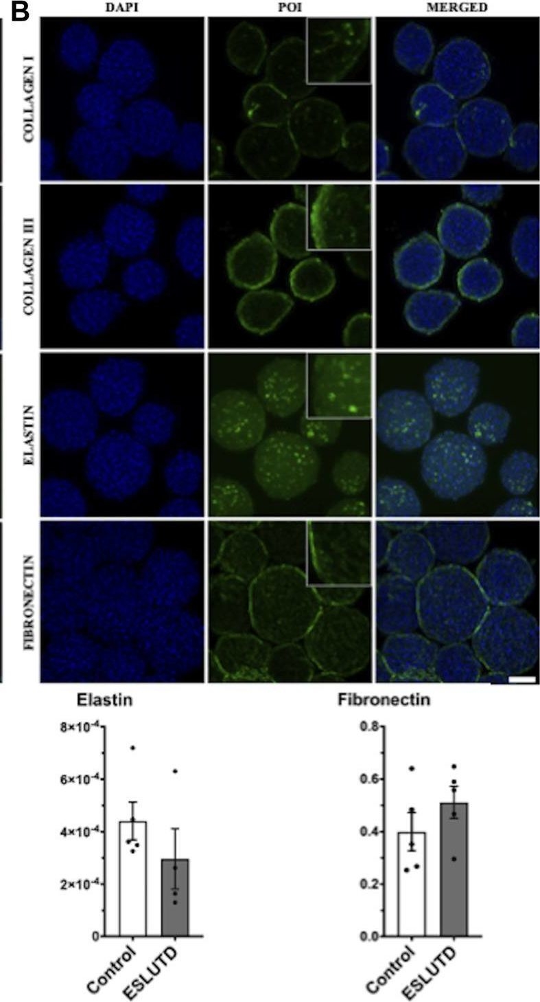 Fig.3.B showing Immunocytochemistry-immunofluorescence in a Homo sapiens (Human) sample from the publication: Improved contractile potential in detrusor microtissues from pediatric patients with end stage lower urinary tract dysfunction.