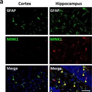 Fig.4.A showing Immunohistochemistry-immunofluorescence in a Mus musculus (House mouse) sample from the publication: Single Cell-Type Spatial Proteomics Uncovers Regional Heterogeneity of Astrocytes.