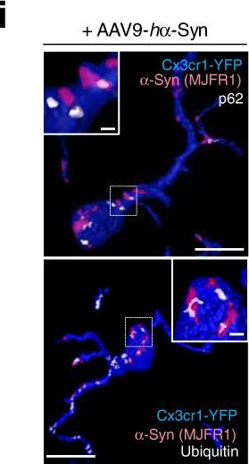 Microglia clear neuron-released α-synuclein via selective autophagy and prevent neurodegeneration.