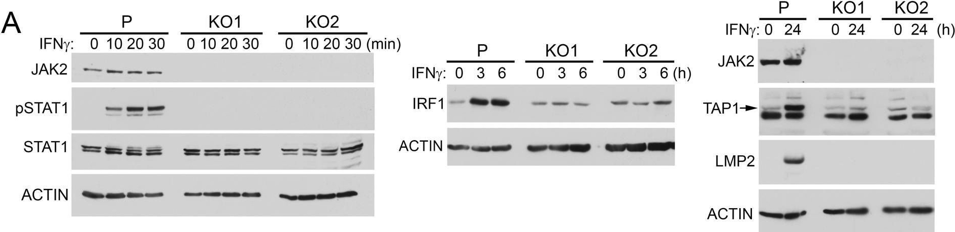 Fig.5.A showing Western Blotting in a Homo sapiens (Human) sample from the publication: Genetic defects of the IRF1-mediated major histocompatibility complex class I antigen presentation pathway occur prevalently in the JAK2 gene in non-small cell lung cancer.