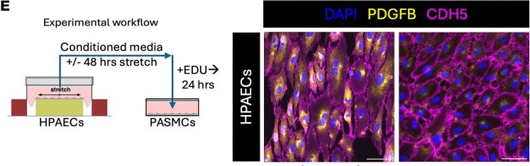 Fig.4.E showing Immunohistochemistry-immunofluorescence from the publication: Pulsatile flow dynamics maintain pulmonary artery architecture.