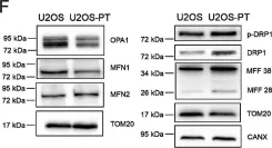 Fig.1.F showing Western Blotting in a Homo sapiens (Human) sample from the publication: Cisplatin resistance can be curtailed by blunting Bnip3-mediated mitochondrial autophagy.