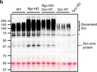 Fig.1.H showing Western Blotting in a Mus musculus (House mouse) sample from the publication: Pivotal roles of biglycan and decorin in regulating bone mass, water retention, and bone toughness.