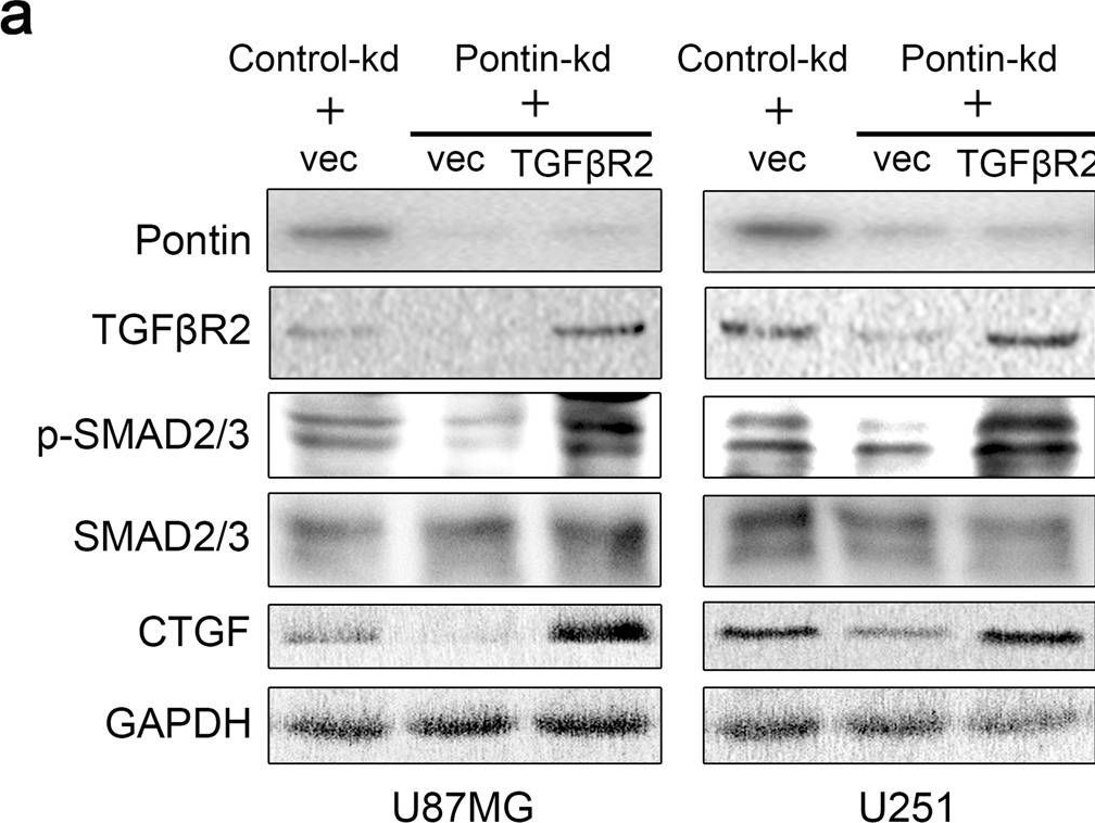 Fig.7.A showing Western Blotting in a Homo sapiens (Human) sample from the publication: Recruitment of LEF1 by Pontin chromatin modifier amplifies TGFBR2 transcription and activates TGFβ/SMAD signalling during gliomagenesis.