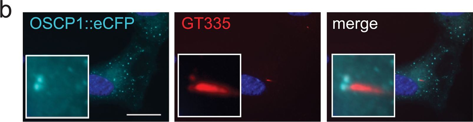 Fig.5.B showing Immunocytochemistry-immunofluorescence in a Caenorhabditis elegans sample from the publication: CiliaCarta: An integrated and validated compendium of ciliary genes.