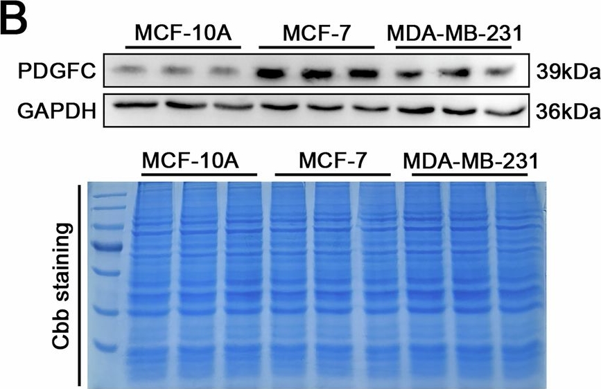 Fig.5.B showing Western Blotting from the publication: NRG1/PDGFC loop between fibroblasts and cancer cells drives paclitaxel resistance via ferroptosis suppression in breast cancer.