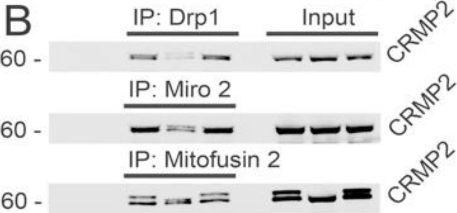 Fig.5.B showing Western Blotting in a Mus musculus (House mouse) sample from the publication: CRMP2 Participates in Regulating Mitochondrial Morphology and Motility in Alzheimer's Disease.