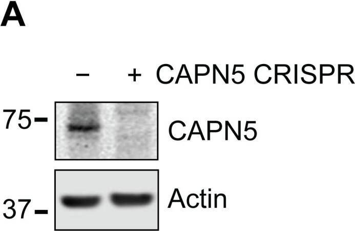 Fig.1.A showing Western Blotting in a Homo sapiens (Human) sample from the publication: The Identification of Proteolytic Substrates of Calpain-5 with N-Terminomics.