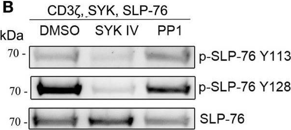 Fig.3.B showing Western Blotting from the publication: Differential Requirements for Src-Family Kinases in SYK or ZAP70-Mediated SLP-76 Phosphorylation in Lymphocytes.