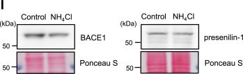 Fig.6.I showing Western Blotting in a Homo sapiens (Human) sample from the publication: Ammonia induces amyloidogenesis in astrocytes by promoting amyloid precursor protein translocation into the endoplasmic reticulum.