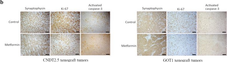 Fig.1.B showing Immunohistochemistry in a Homo sapiens (Human) sample from the publication: Metformin inhibits small intestinal neuroendocrine tumor growth in vivo.