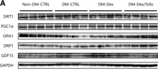 Fig.5.A showing Western Blotting from the publication: Effect of Tofogliflozin on Skeletal Muscle Mitochondrial Function in Male Diabetic Mice With Muscle Atrophy.
