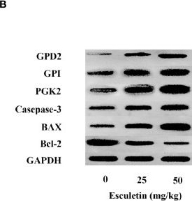 Fig.7.B showing Western Blotting in a Homo sapiens (Human) sample from the publication: Esculetin Inhibits Cancer Cell Glycolysis by Binding Tumor PGK2, GPD2, and GPI.