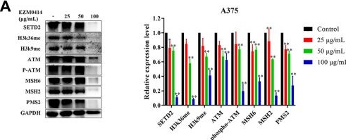 Fig.4.A showing Western Blotting in a Homo sapiens (Human) sample from the publication: Prognostic and therapeutic roles of SETD2 in cutaneous melanoma.