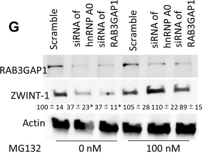 Fig.5.G showing Western Blotting in a Homo sapiens (Human) sample from the publication: A tumor-specific modulation of heterogeneous ribonucleoprotein A0 promotes excessive mitosis and growth in colorectal cancer cells.