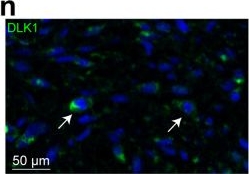 Fig.6.N showing Immunohistochemistry-immunofluorescence from the publication: Proteomic landscape analysis of undifferentiated pleomorphic sarcoma.