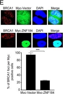 Fig.3.E showing Immunocytochemistry-immunofluorescence in a Homo sapiens (Human) sample from the publication: ZNF184 negatively regulates HR repair and predicts poor prognosis in acute lymphoblastic leukemia.