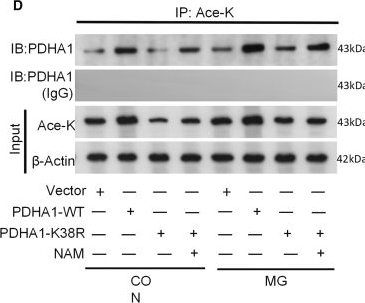 Fig.7.D showing Western Blotting in a Homo sapiens (Human) sample from the publication: SIRT3 regulates PDHA1 acetylation in HUVECs to modulate inflammation and pyroptosis under clinorotation.