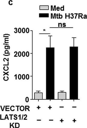 Fig.5.C showing Enzyme-linked immunosorbent assay from the publication: Mycobacterium tuberculosis-triggered Hippo pathway orchestrates CXCL1/2 expression to modulate host immune responses.