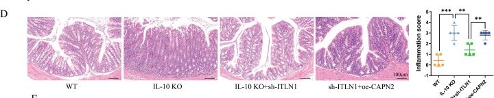 Fig.9.D showing Immunohistochemistry in a Mus musculus (House mouse) sample from the publication: ITLN1 exacerbates Crohn's colitis by driving ZBP1-dependent PANoptosis in intestinal epithelial cells through antagonizing TRIM8-mediated CAPN2 ubiquitination.