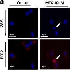 Fig.5.A showing Immunocytochemistry-immunofluorescence in a Homo sapiens (Human) sample from the publication: Methotrexate upregulates circadian transcriptional factors PAR bZIP to induce apoptosis on rheumatoid arthritis synovial fibroblasts.
