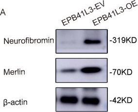 Fig.8.A showing Western Blotting from the publication: Loss of EPB41L3: a common molecular link in the tumorigenesis of neurofibromatosis types 1 and 2.