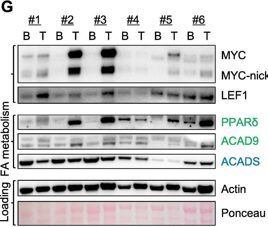 Fig.6.G showing Western Blotting in a Homo sapiens (Human) sample from the publication: Induction of LEF1 by MYC activates the WNT pathway and maintains cell proliferation.