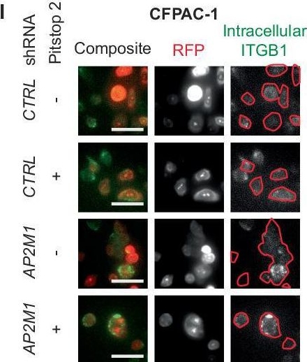 Fig.4.I showing Immunocytochemistry-immunofluorescence in a Homo sapiens (Human) sample from the publication: The essential clathrin adapter protein complex-2 is tumor suppressive specifically in vivo.