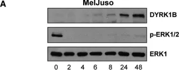 Fig.6.A showing Western Blotting from the publication: Identification of DYRK1B as a substrate of ERK1/2 and characterisation of the kinase activity of DYRK1B mutants from cancer and metabolic syndrome.