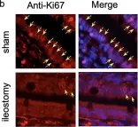 Fig.5.B showing Immunohistochemistry in a Rattus norvegicus (Rat) sample from the publication: A new murine ileostomy model: recycling stool prevents intestinal atrophy in the distal side of ileostomy.