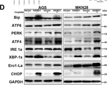 Fig.5.D showing Western Blotting from the publication: The developmental regulator HAND1 inhibits gastric carcinogenesis through enhancing ER stress apoptosis via targeting CHOP and BAK which is augmented by cisplatin.