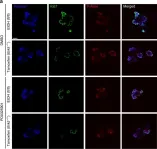 Fig.5.A showing Immunohistochemistry-immunofluorescence in a Mus musculus (House mouse) sample from the publication: ERK5 signalling rescues intestinal epithelial turnover and tumour cell proliferation upon ERK1/2 abrogation.