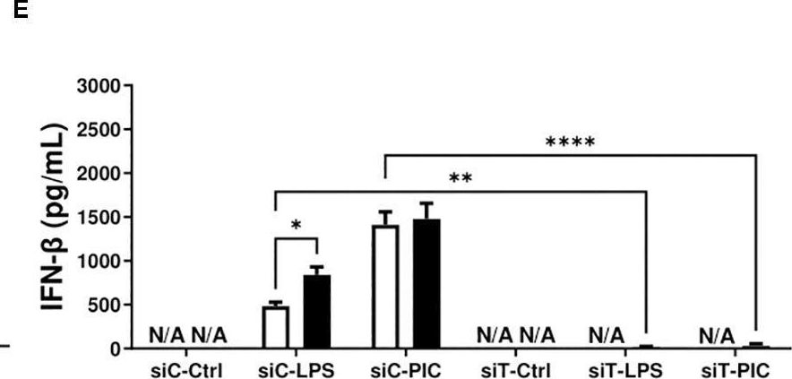 Fig.4.E showing Enzyme-linked immunosorbent assay from the publication: SIFD-associated TRNT1 deficiency unveils importance of TSPO during macrophage antibacterial and antiviral responses.