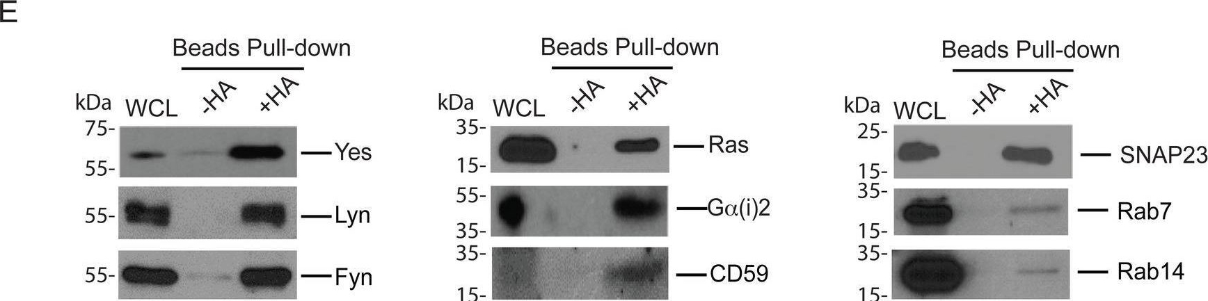 Fig.2.E showing Western Blotting from the publication: Acid Sphingomyelinase regulates the localization and trafficking of palmitoylated proteins.