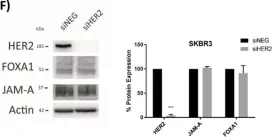 Fig.6.F showing Western Blotting from the publication: A Transcriptional Link between HER2, JAM-A and FOXA1 in Breast Cancer.