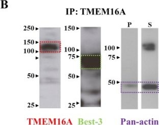 Fig.3.B showing Western Blotting from the publication: Ca2+-Activated Cl- Channels: Do Bestrophins and TMEM16A Interact?