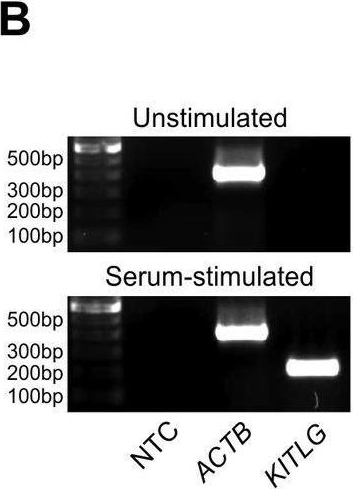 Fig.4.B showing Western Blotting in a Homo sapiens (Human) sample from the publication: Membrane-to-nucleus signaling links insulin-like growth factor-1- and stem cell factor-activated pathways.