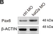 Fig.2.B showing Western Blotting from the publication: Histone acetyltransferase KAT2A modulates neural stem cell differentiation and proliferation by inducing degradation of the transcription factor PAX6.