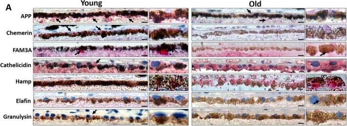 Fig.3.A showing Immunohistochemistry from the publication: Senescence Alters Antimicrobial Peptide Expression and Induces Amyloid-β Production in Retinal Pigment Epithelial Cells.