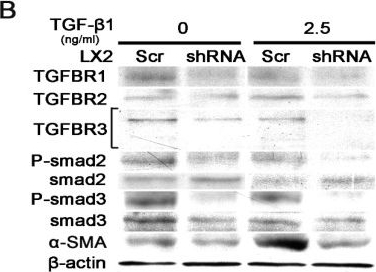 Fig.5.B showing Western Blotting from the publication: Sulfatase-2 Regulates Liver Fibrosis through the TGF-β Signaling Pathway.