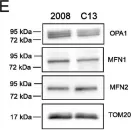 Fig.1.E showing Western Blotting in a Homo sapiens (Human) sample from the publication: Cisplatin resistance can be curtailed by blunting Bnip3-mediated mitochondrial autophagy.