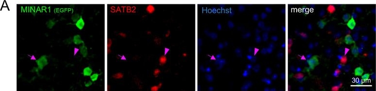Fig.2.A showing Immunohistochemistry-immunofluorescence in an Equus caballus (Horse) sample from the publication: Cortical Somatostatin Neurons Regulate Seizure Susceptibility via MINAR1/Gαs-cAMP Signaling.