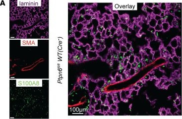 Fig.2.A showing Immunohistochemistry-immunofluorescence from the publication: Neutrophil-specific Shp1 loss results in lethal pulmonary hemorrhage in mouse models of acute lung injury.