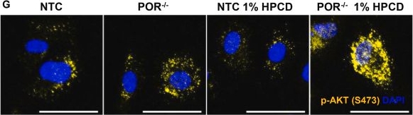 Fig.5.G showing Immunocytochemistry-immunofluorescence from the publication: Endothelial cytochrome P450 -derived cholesterol limits angiogenesis.