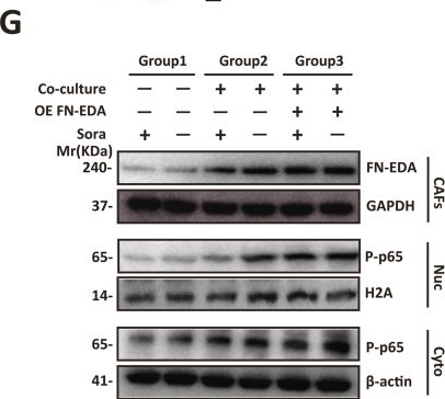 Fig.2.G showing Western Blotting from the publication: Cancer-associated fibroblasts derived fibronectin extra domain A promotes sorafenib resistance in hepatocellular carcinoma cells by activating SHMT1.