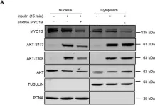 Fig.1.A showing Western Blotting from the publication: Myosin 1b Regulates Nuclear AKT Activation by Preventing Localization of PTEN in the Nucleus.