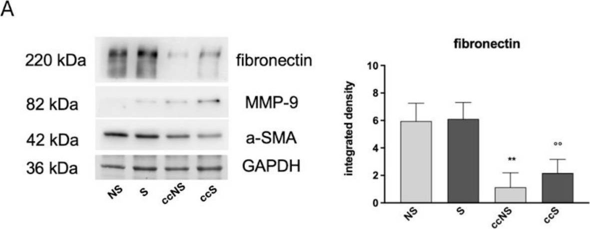 Fig.6.A showing Western Blotting in a Homo sapiens (Human) sample from the publication: Dental Pulp Stem Cells Modulate Inflammasome Pathway and Collagen Deposition of Dermal Fibroblasts.