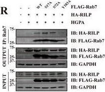 Fig.5.R showing Western Blotting in a Mus musculus (House mouse) sample from the publication: Targeting Rab7-Rilp Mediated Microlipophagy Alleviates Lipid Toxicity in Diabetic Cardiomyopathy.